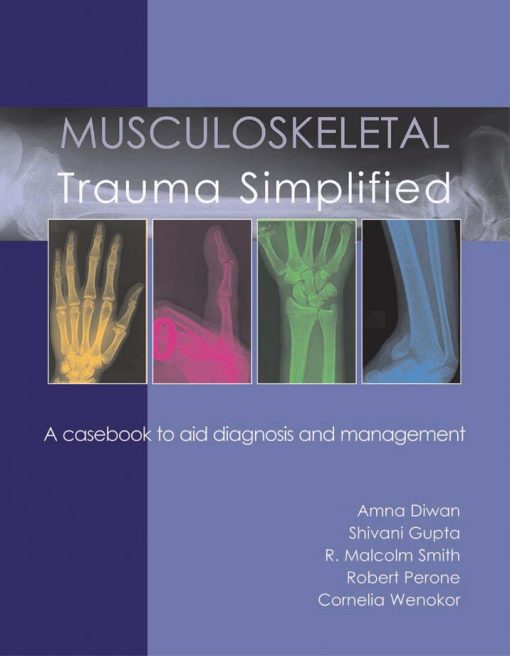 Musculoskeletal Trauma Simplified (ePub Book)