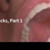 Spear-Mandibular Nerve Blocks, Part 1