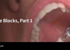 Spear-Mandibular Nerve Blocks, Part 1