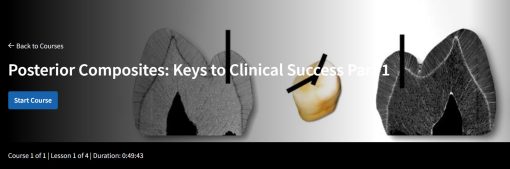 Spear-Posterior Composites: Keys to Clinical Success Part 1