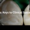 Spear-Posterior Composites: Keys to Clinical Success, Part 2