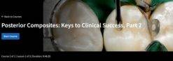 Spear-Posterior Composites: Keys to Clinical Success, Part 2