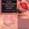 Combination Facial Reconstruction after Mohs Surgery (EPUB eBook)