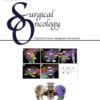 Surgical Oncology PDF