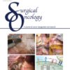 Surgical Oncology Volume 51