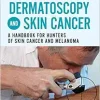 Dermatoscopy and Skin Cancer, updated edition: A handbook for hunters of skin cancer and melanoma (PDF)