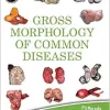 Gross Morphology of Common Diseases (ePub Book)