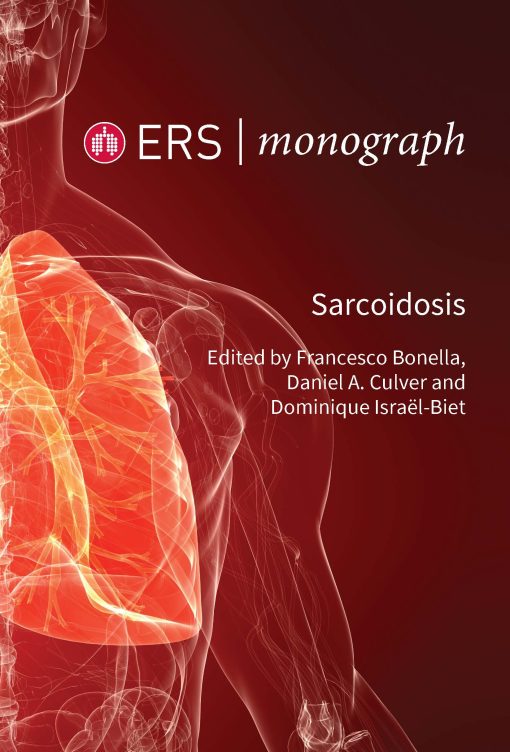 Sarcoidosis (PDF)