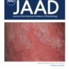 Journal of the American Academy of Dermatology PDF