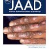 Journal of the American Academy of Dermatology PDF