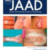 Journal of the American Academy of Dermatology PDF