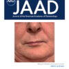 Journal of the American Academy of Dermatology PDF