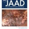 Journal of the American Academy of Dermatology PDF