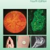 Atlas of Diabetes Mellitus, 4th edition (PDF)