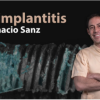 Peri-Implantitis: Prevention and Treatment (Dental Course)