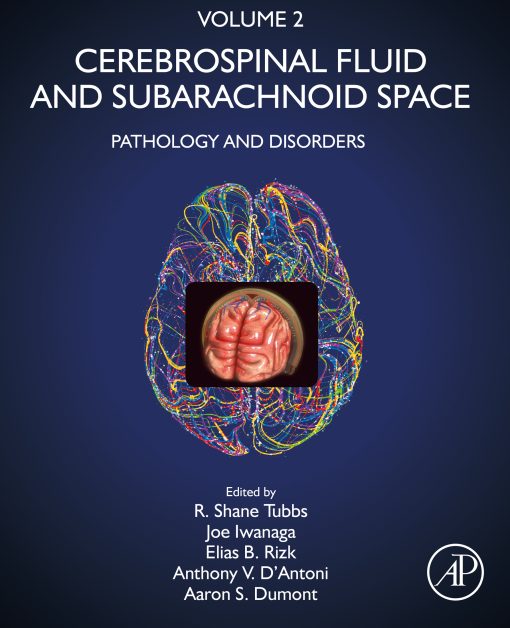 Cerebrospinal Fluid and Subarachnoid Space, Volume 2: Pathology and Disorders (EPUB)