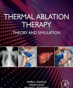 Thermal Ablation Therapy: Theory and Simulation (EPUB)