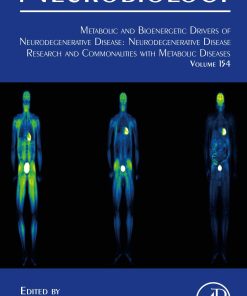 Metabolic and Bioenergetic Drivers of Neurodegenerative Disease: Neurodegenerative Disease Research and Commonalities with Metabolic Diseases, Volume 154 (EPUB)