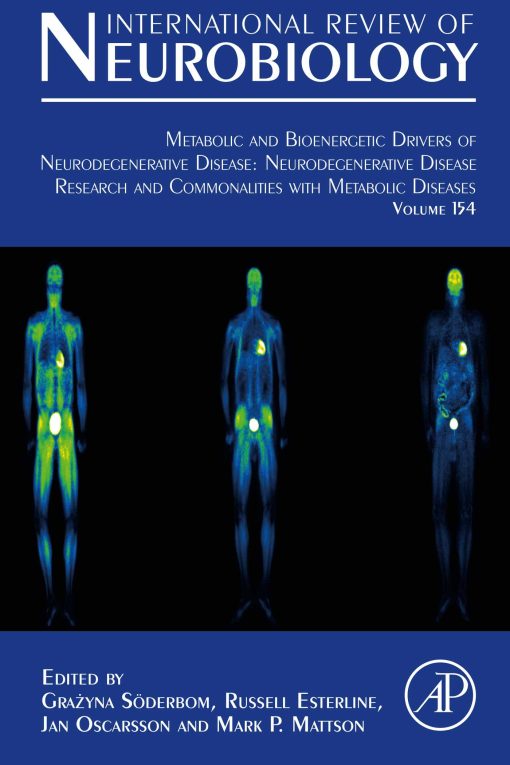 Metabolic and Bioenergetic Drivers of Neurodegenerative Disease: Neurodegenerative Disease Research and Commonalities with Metabolic Diseases, Volume 154 (EPUB)