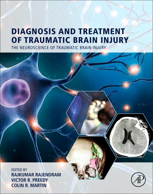 Diagnosis and Treatment of Traumatic Brain Injury (EPUB)