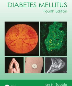 Atlas Of Diabetes Mellitus, 4th Edition (EPUB)