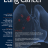 Clinical Lung Cancer PDF