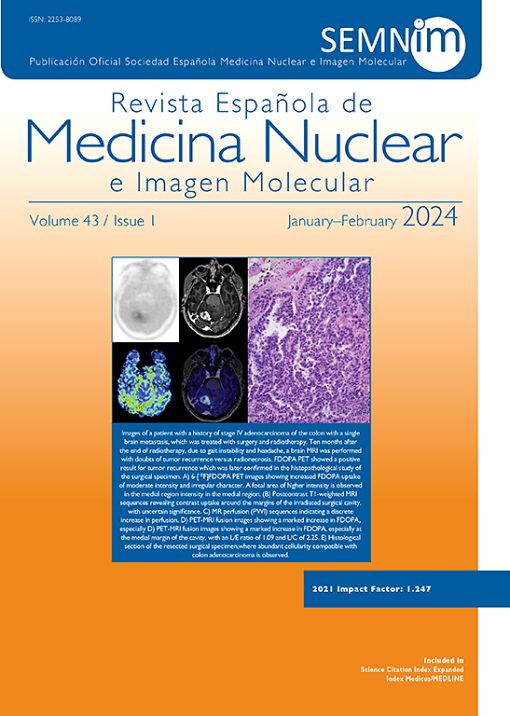 Revista Española de Medicina Nuclear e Imagen Molecular (English Edition) PDF