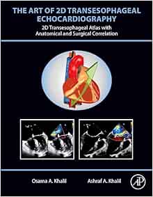 The Art Of 2D Transesophageal Echocardiography: 2D Transesophageal Atlas With Anatomical And Surgical Correlation (PDF)