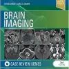 Brain Imaging: Case Review Series, 3rd Edition (PDF)