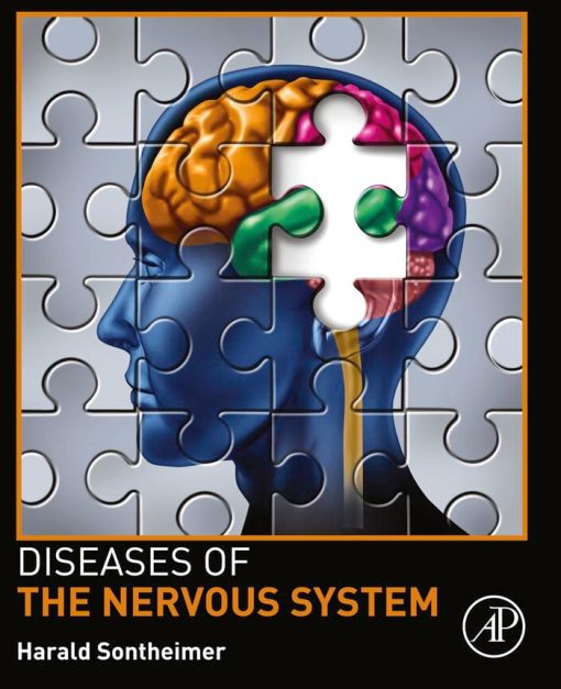 Diseases Of The Nervous System (PDF)