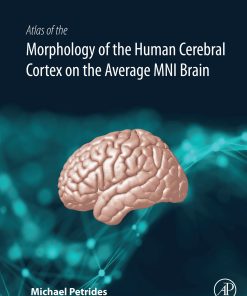 Atlas Of The Morphology Of The Human Cerebral Cortex On The Average MNI Brain (EPUB)