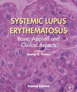 Systemic Lupus Erythematosus: Basic, Applied And Clinical Aspects, 2nd Edition (EPUB)