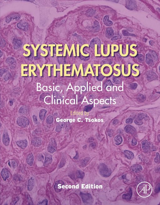 Systemic Lupus Erythematosus: Basic, Applied And Clinical Aspects, 2nd Edition (EPUB)