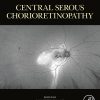 Central Serous Chorioretinopathy (PDF)