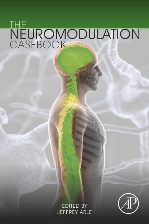 The Neuromodulation Casebook (EPUB)