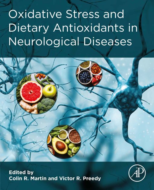 Oxidative Stress And Dietary Antioxidants In Neurological Diseases (EPUB)