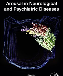 Arousal In Neurological And Psychiatric Diseases (EPUB)