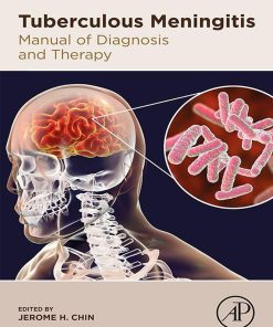 Tuberculous Meningitis: Manual Of Diagnosis And Therapy (EPUB)