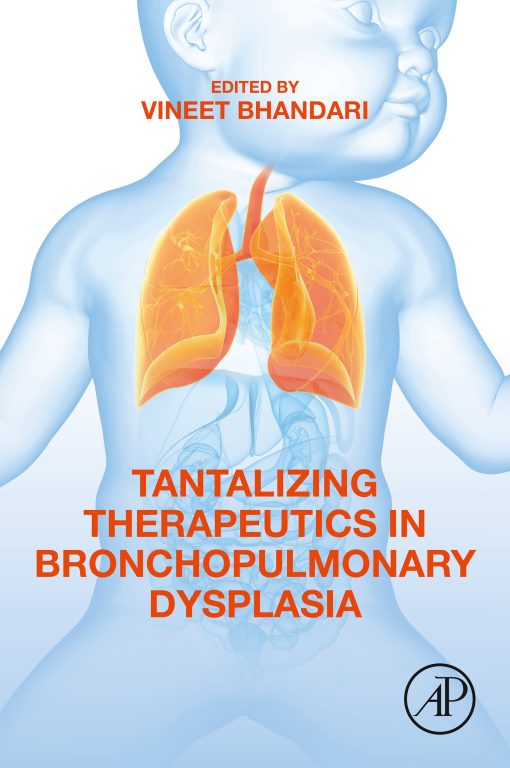 Tantalizing Therapeutics In Bronchopulmonary Dysplasia (EPUB)