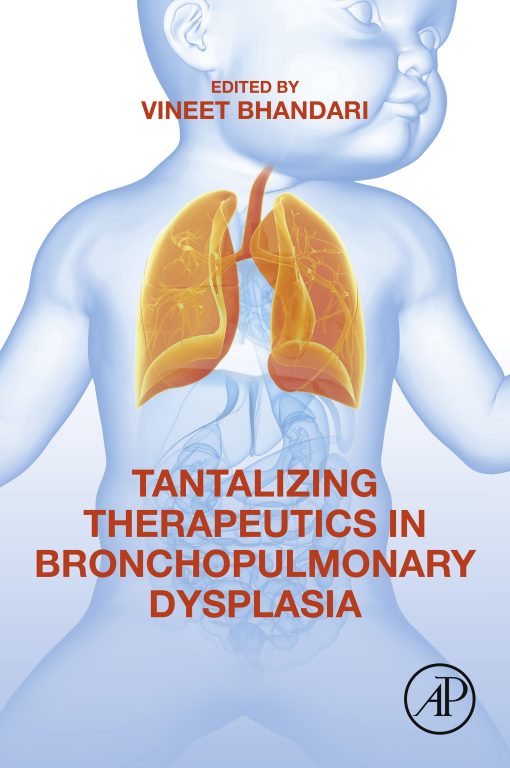 Tantalizing Therapeutics In Bronchopulmonary Dysplasia (PDF)