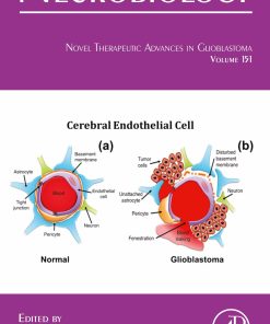 Novel Therapeutic Advances In Glioblastoma (Volume 151) (International Review Of Neurobiology (Volume 151) (EPUB)