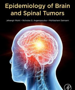 Epidemiology Of Brain And Spinal Tumors (EPUB)