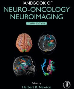 Handbook Of Neuro-Oncology Neuroimaging, 3rd Edition (EPUB)