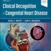 Perloff’s Clinical Recognition Of Congenital Heart Disease, 7th Edition (EPUB)