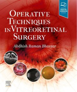 Operative Techniques In Vitreoretinal Surgery (EPUB)