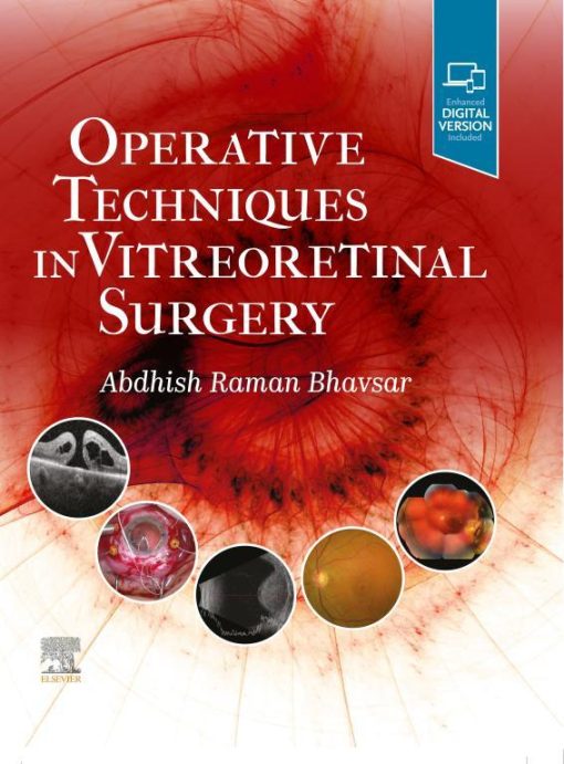 Operative Techniques In Vitreoretinal Surgery (EPUB)