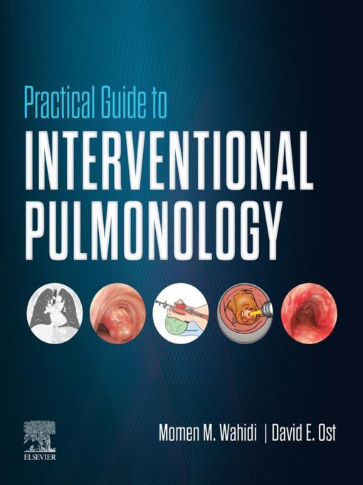 Practical Guide To Interventional Pulmonology (EPUB)