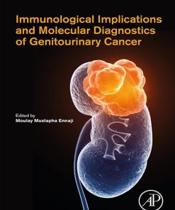 Immunological Implications And Molecular Diagnostics Of Genitourinary Cancer (EPUB)