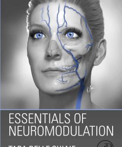 Essentials Of Neuromodulation (EPUB)