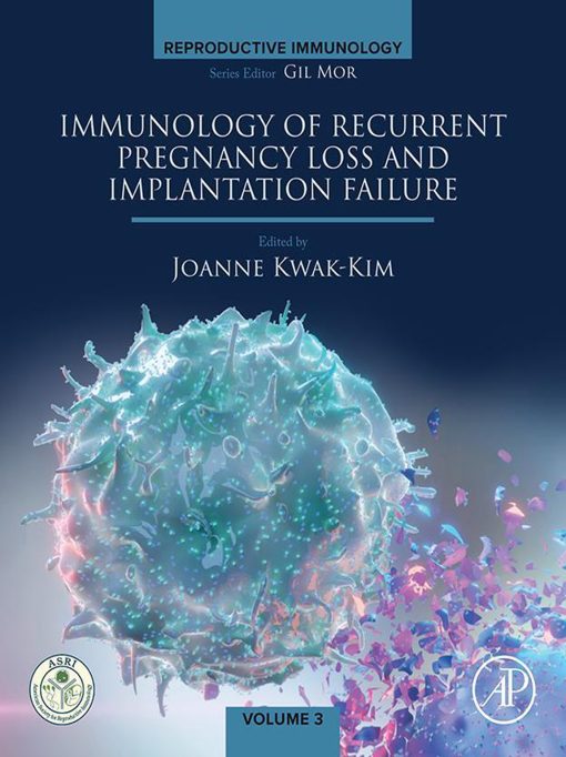 Immunology Of Recurrent Pregnancy Loss And Implantation Failure (EPUB)